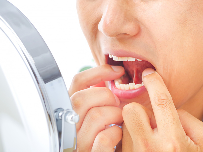 口腔がん検診について