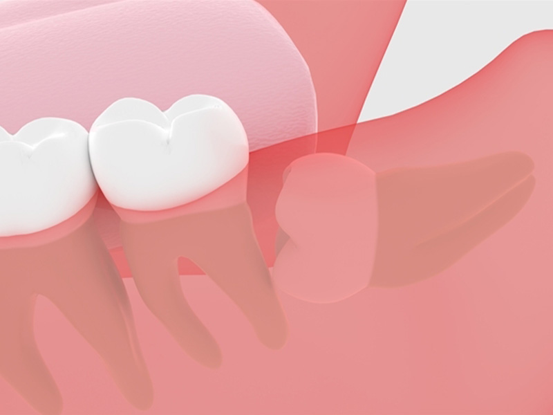 歯科口腔外科をご存じでしょうか